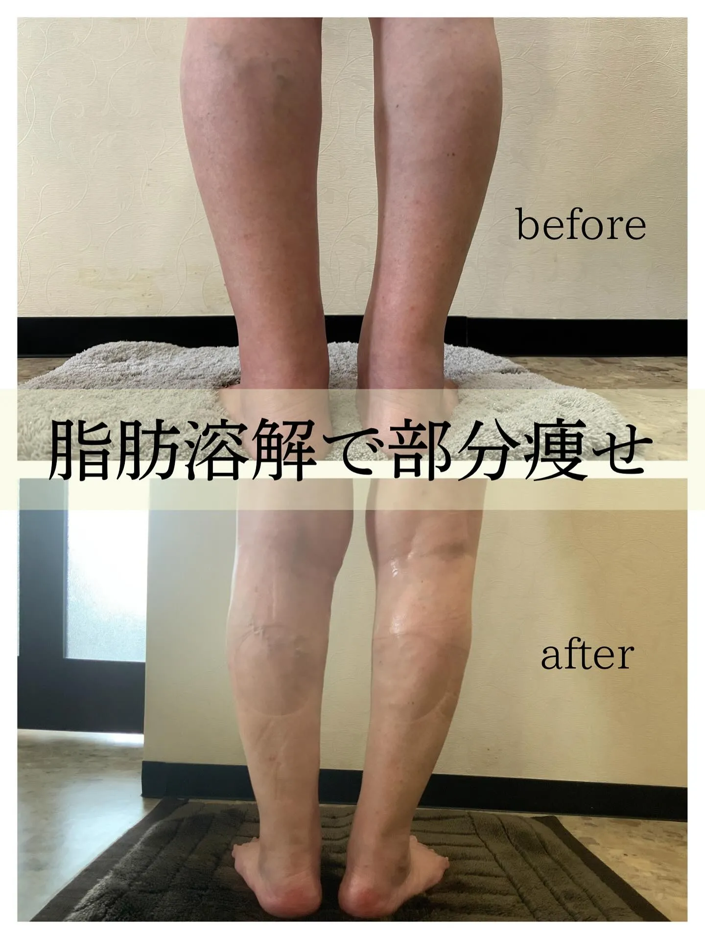 ◆脚痩せ