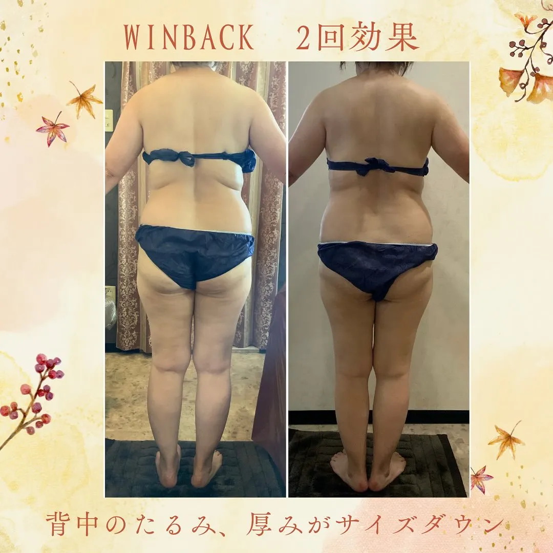 ウィンバック症例