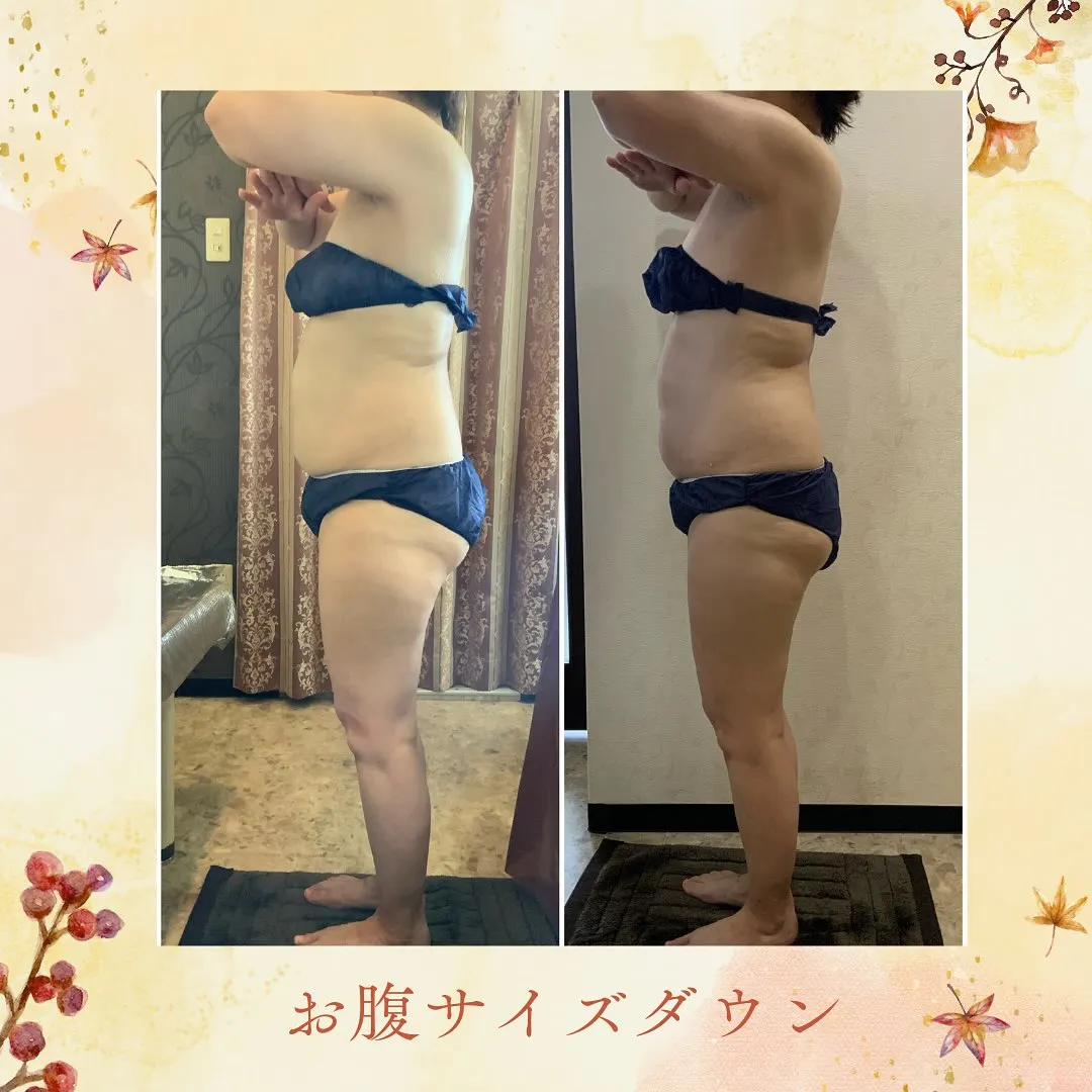 ウィンバック症例