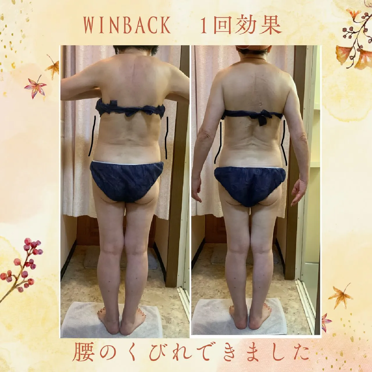 ウィンバック症例