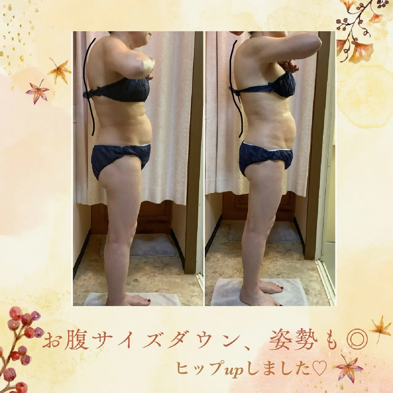 ウィンバック症例