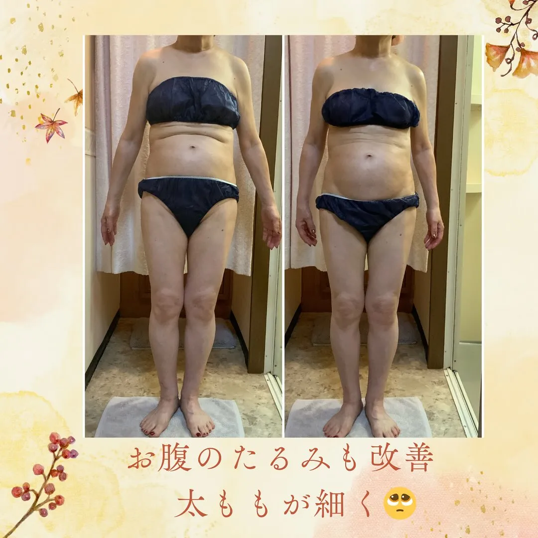 ウィンバック症例